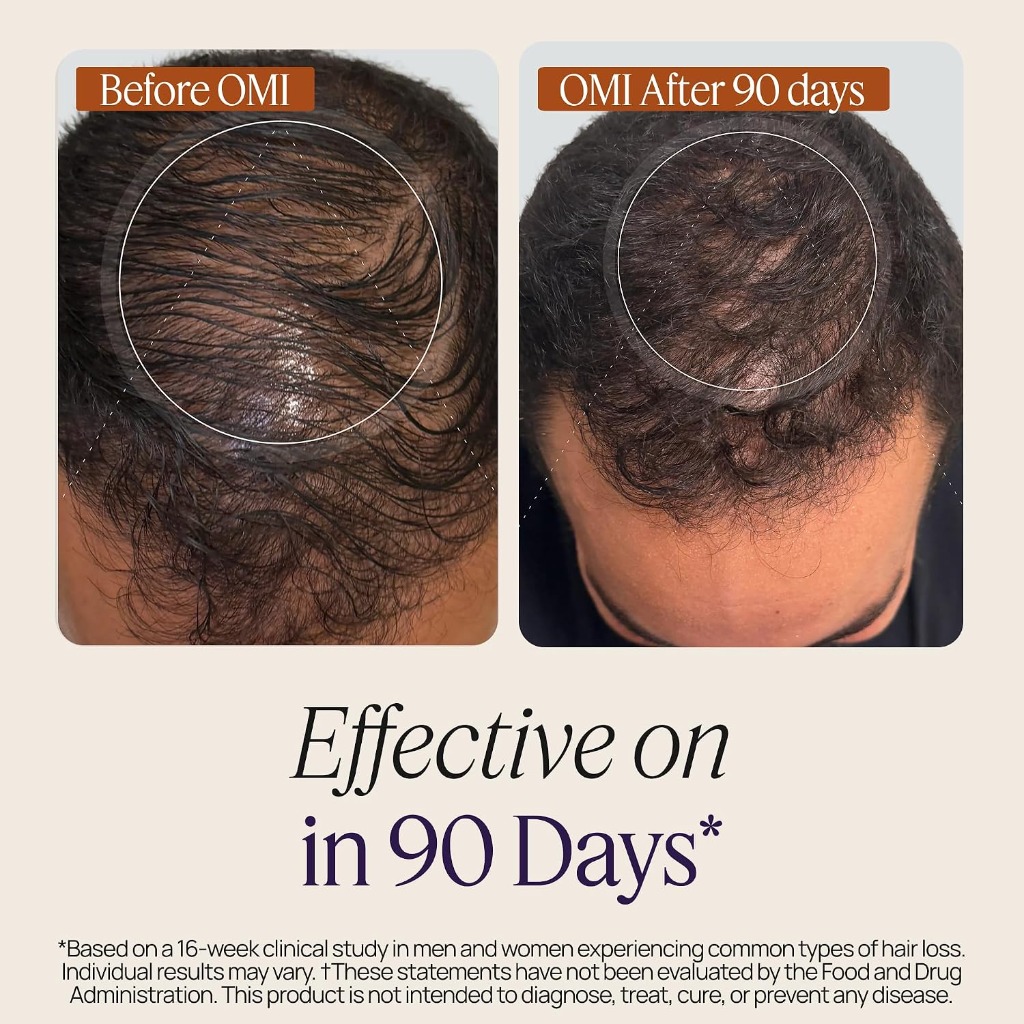 OMI Before and After Results